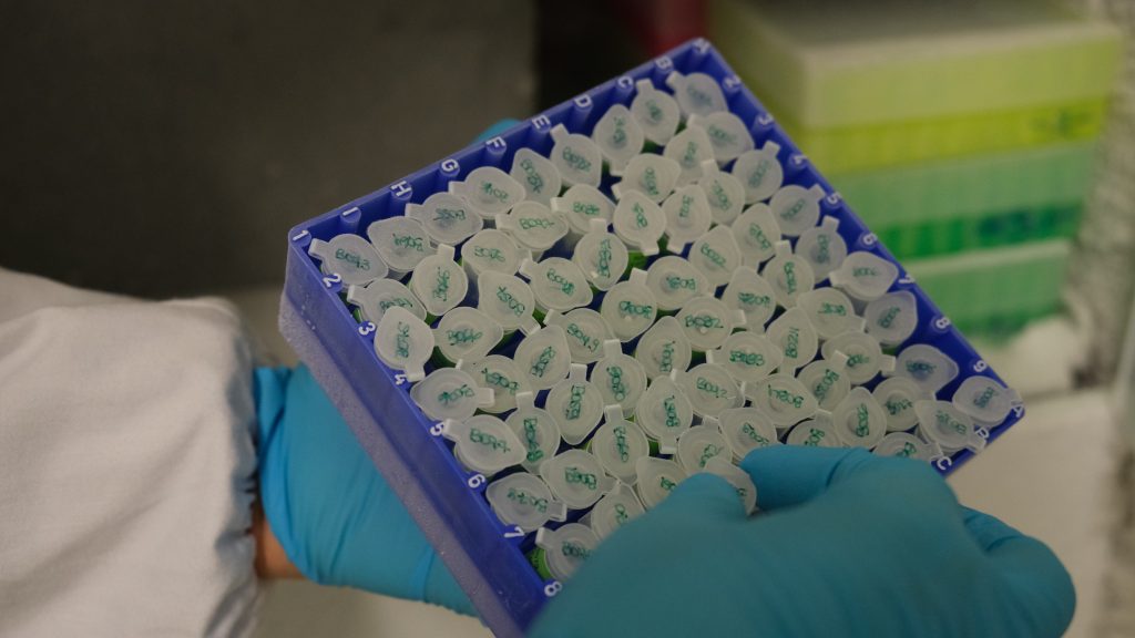 Study Sample Collection Images The challenges of sample collection in our human genetic diversity ...